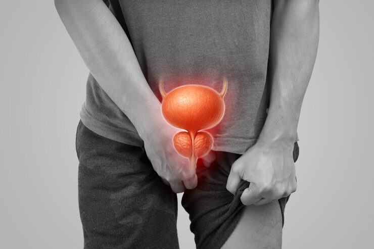 Urethral Cancer